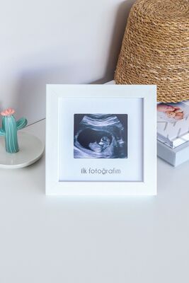 My First Photo Baby Ultrasound Frame FFZ746662976962 - 1